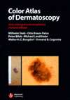 Color Atlas of Dermatoscopy, 2nd, enlarged and completely revised 