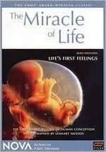   Nova The Miracle of Life by Wgbh / Pbs  DVD