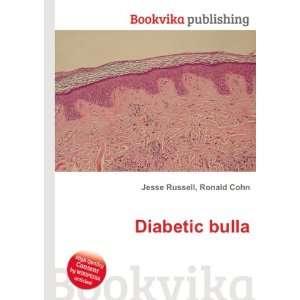  Diabetic bulla Ronald Cohn Jesse Russell Books