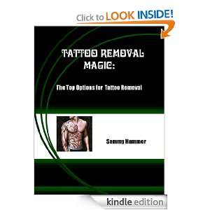 Tattoo Removal Magic The Top Options for Tattoo Removal Sammy Hammer 