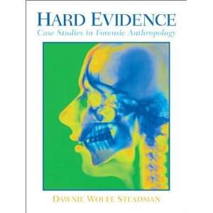  Hard Evidence Case Studies in Forensic Anthropology 