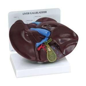  Human Liver & Gallbladder Anatomy Model with gallstones 