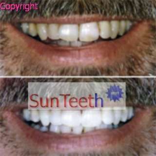 4pcs 44% Teeth Whitener Tooth Gel Whitening Syringes  