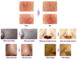 SKIN CARE PUFF 100% NATURAL SILK   Removal Dead Skin Cells, Skin 